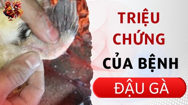 03 triệu chứng nổi bật của bệnh đậu gà